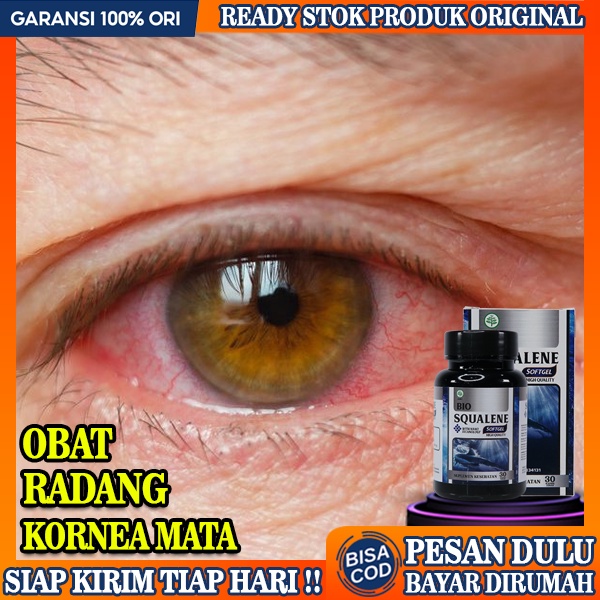 MATA Keratitis Medicine,,,, Herbal Keratitis Eye Cornea Medicine ...