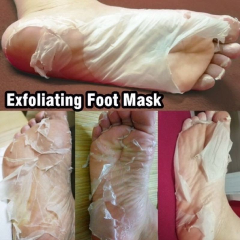 Baby Foot Peel Review: Results, Photos, and Before and After - The