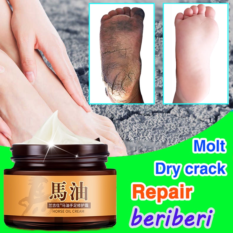 Dry Hands And Feet Cream Antifreeze And Anticrack Hand Cream for Cracked Hands Feet Cream Horse
