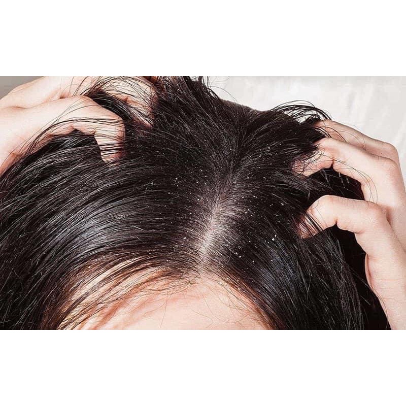 Head & Shoulders AntiDandruff Shampoo, Us Head reduces Dandruff