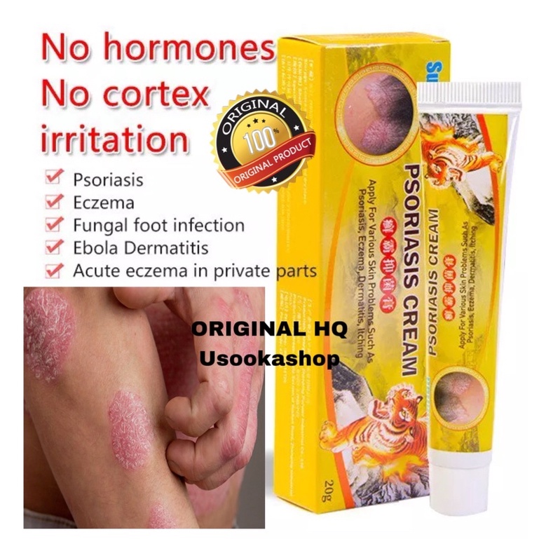 Ubat gatal kulit Psoriasis krim Ekzema berkesan ORIGINAL Sumifun 20g ...