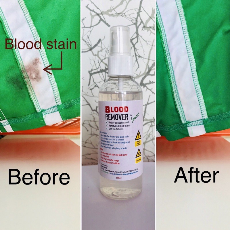 Blood stain remover for fabrics Pencuci kesan darah pada fabrik