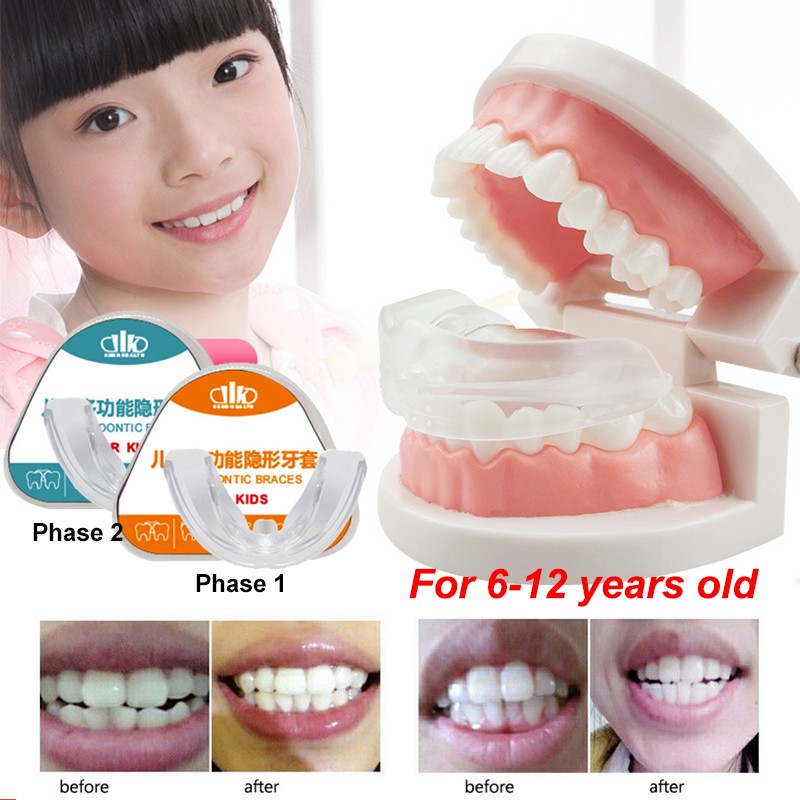 Children Orthodontic Teeth Retainer Dental Straighten Corrector Braces ...