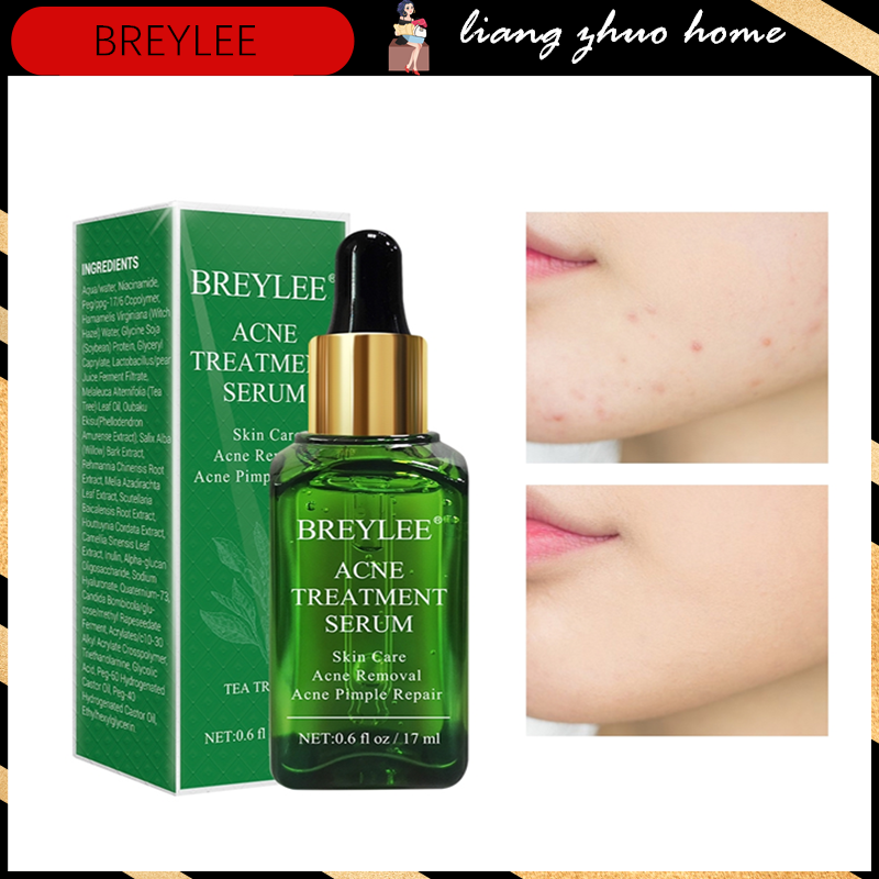 Ready Stock Breylee Acne Treatment Serum Face Essence Anti Acne Scar Removal Cream 17ml 3288