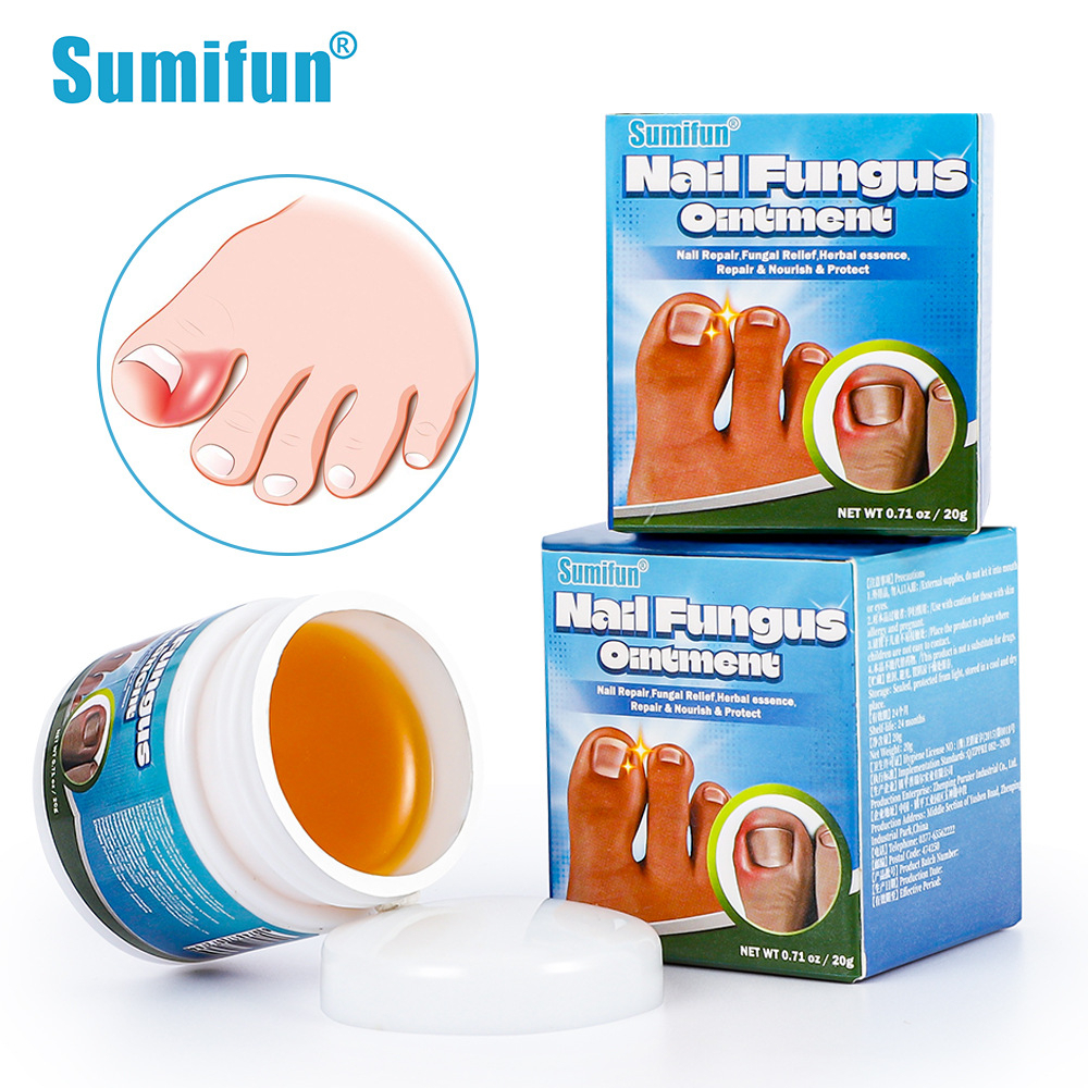 Sumifun Nail Fungus Treatment Cream Viral Cream Masalah Kuku 20g ...