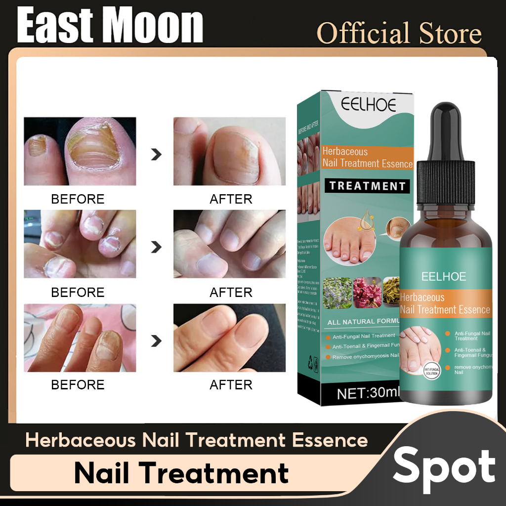 EELHOE Nail Fungus Treatment Best Nail Repair Stop Fungal Growth ...