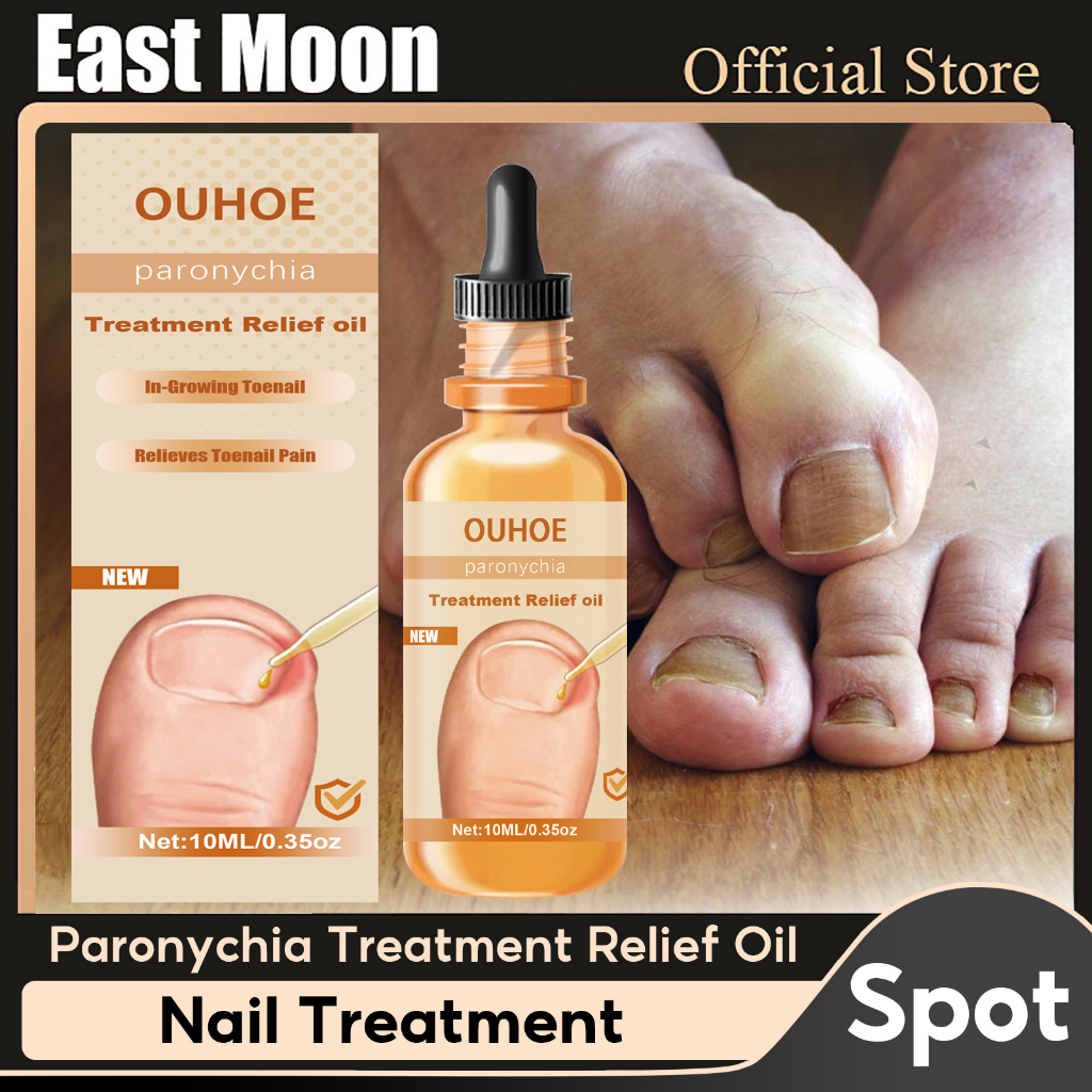 OUHOE Paronychia Treatment Relief Oil Onychomycosis Repair Serum Repair