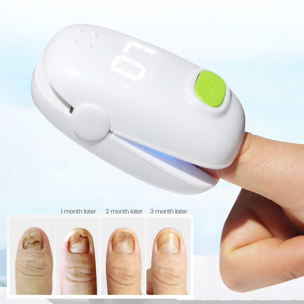 Fithope Nail Fungus Cleaning Device Home Treatment for Toenail Fungus