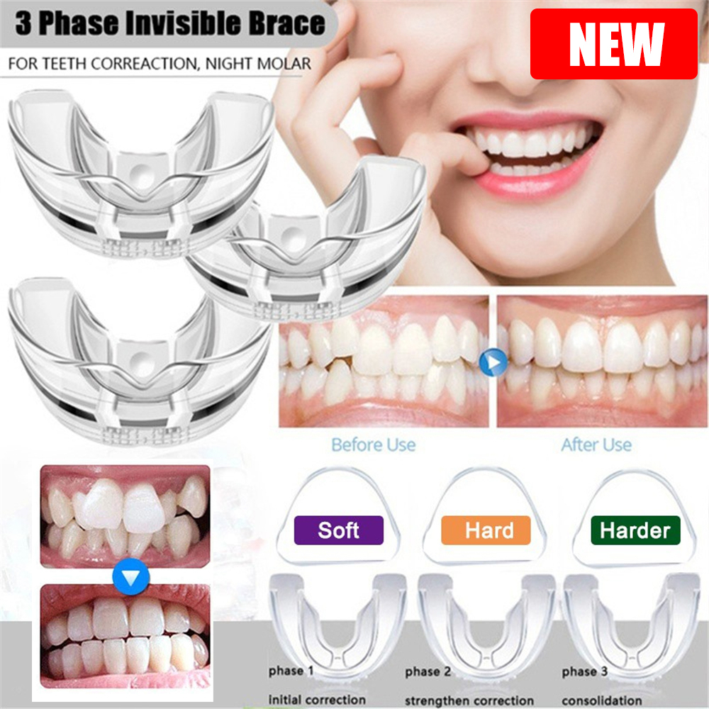 ☺『Ready To Ship 』 High Quality TPE 3 Stages Kids Adult Invisible Dental
