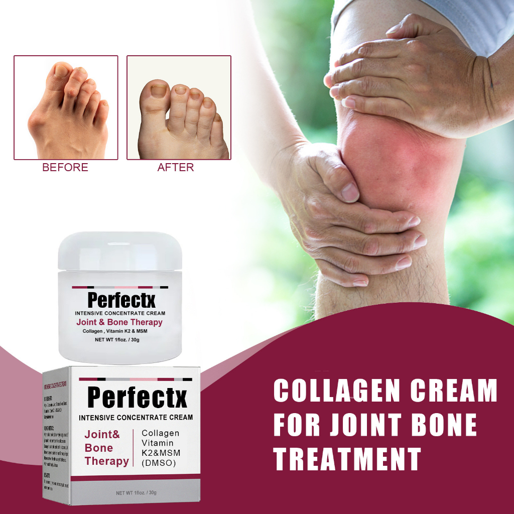 PERFECTX Joint And Bone Therapy Cream Intensive Joint and Bone Therapy Cream Treatment Gout