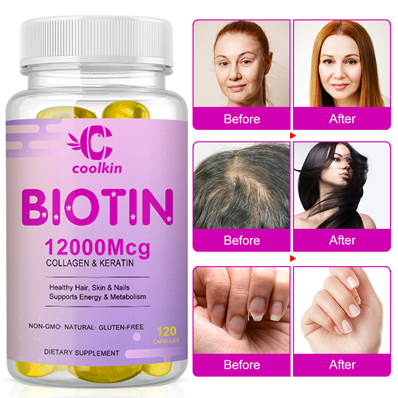 Biotin Capsules Promotes Metabolism Enhances Immunity Promotes Normal ...