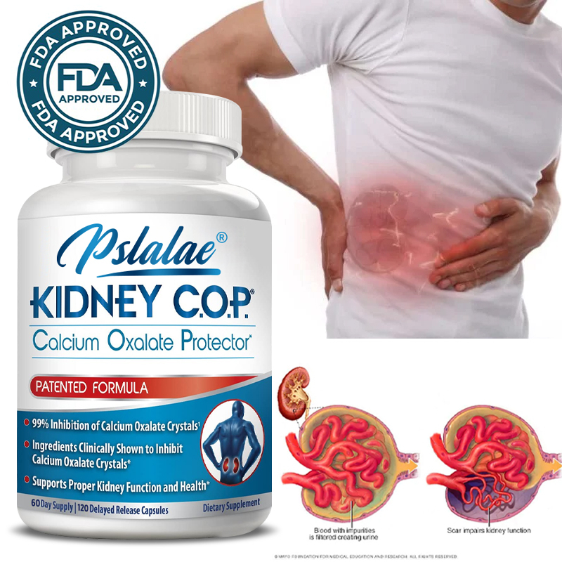 Kidney COP Calcium Oxide Protector, Patented Kidney Support Calcium
