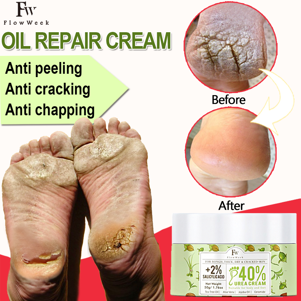 Flow Week Urea Cream Hand Foot Cream Callus Remover Salicylic Acid ...