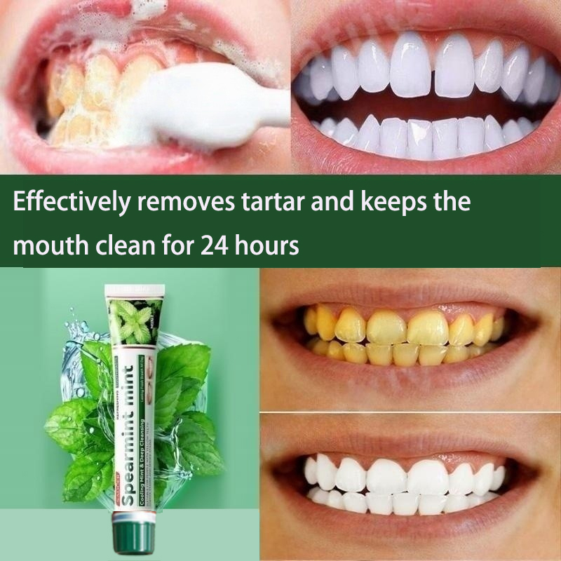Mint Toothpaste, Remove Plaque, Fresh Breath Prevent Tooth Cavity
