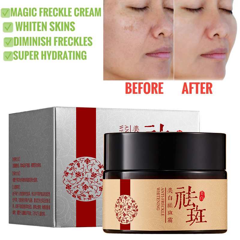 BIOAQUA Anti Freckle Whitening Face Cream Krim Jeragat Freckles Removal ...