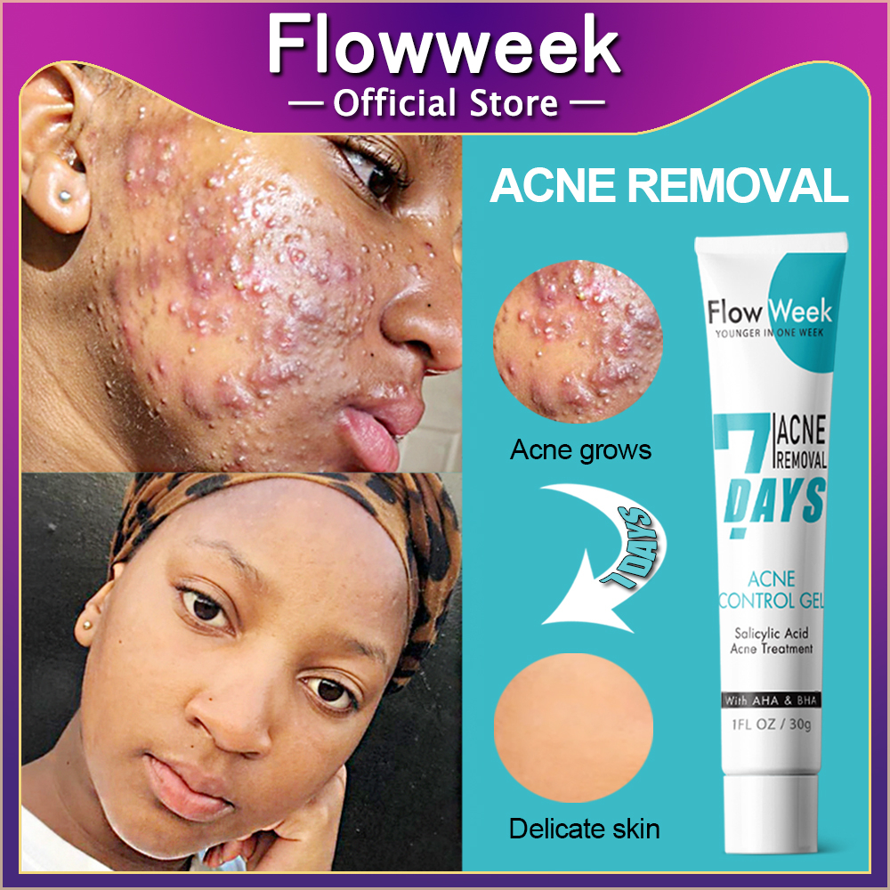 FlowWeek acne scar Face Cream Acne Treatment Blackheads Scar Remover