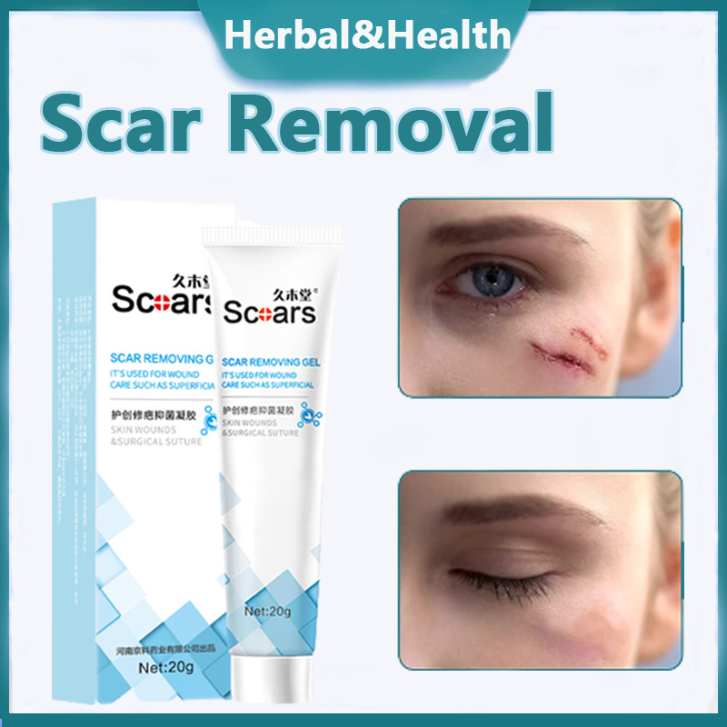 Scar Removal Cream Scar Repair Gel Stretch Marks Burns Parut Treatment