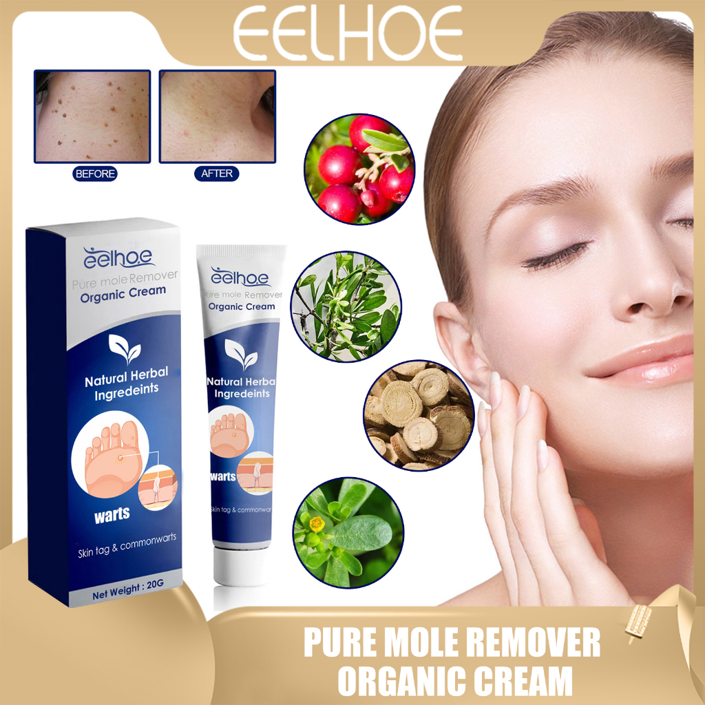 Eelhoe Pure Mole Remover Organic Cream Skin Tags/Warts Remover Original Effective And
