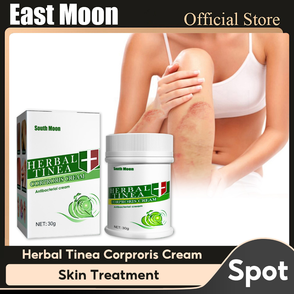 South Moon Herbal Tinea Corporis Anti Itch Cream Dry Itchy Sensitive Relieves Itchy Minor Skin 7960