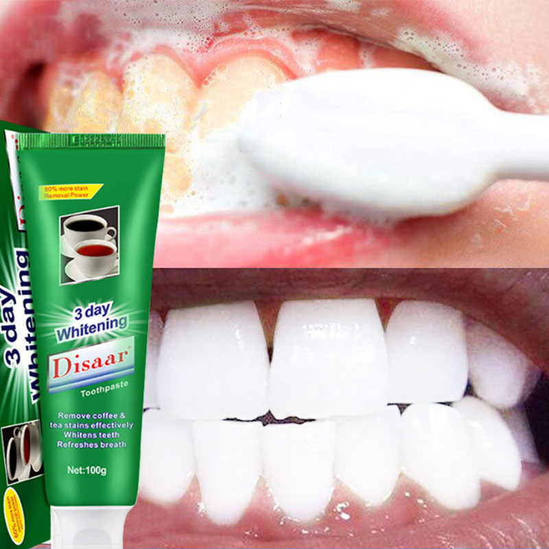 By 3 - Day Whitening Toothpaste Remove Coffee Tea Stain Whitens Teeth ...