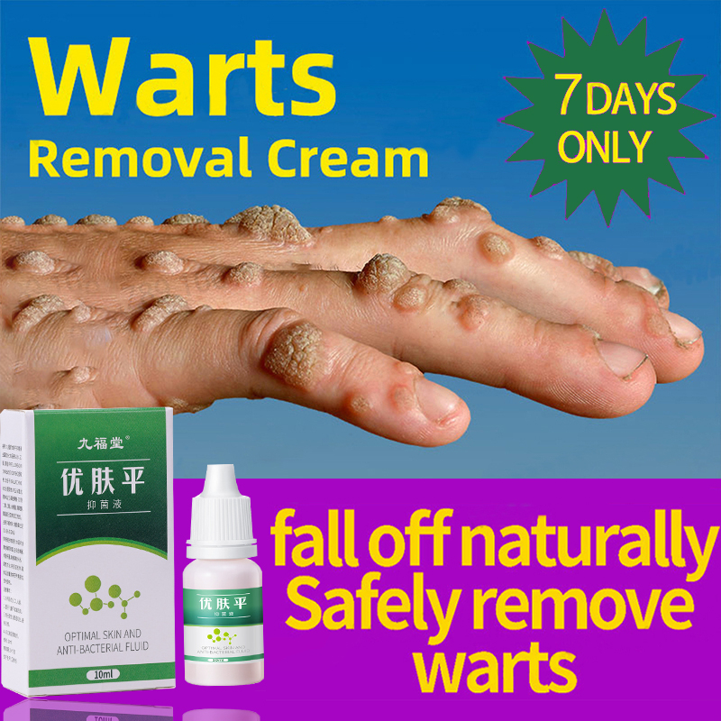 Corn Cream 10 ml Skin tag remover Antibacterial Liquid Remove Toes