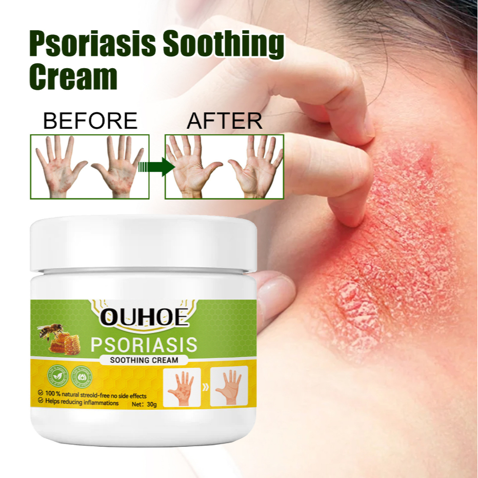 OUHOE Psoriasis Soothing Repair Cream Antibacterial Eczema Treatment