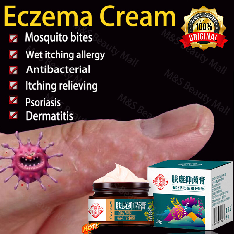 antibacterial止痒膏antibiotic cream30g anti inflammatory/Antipruritic/antibacterial wipe skin cream