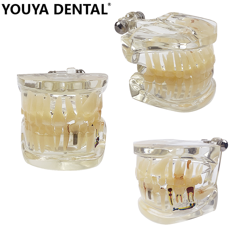 Anatomical pathological model Of The Left Mandible Dental Teaching ...