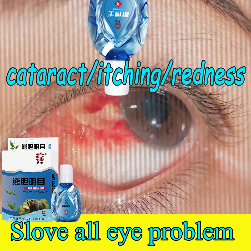 Eye Drops 13ml Eye Problems Therapy Eye Drops myopia astigmatism