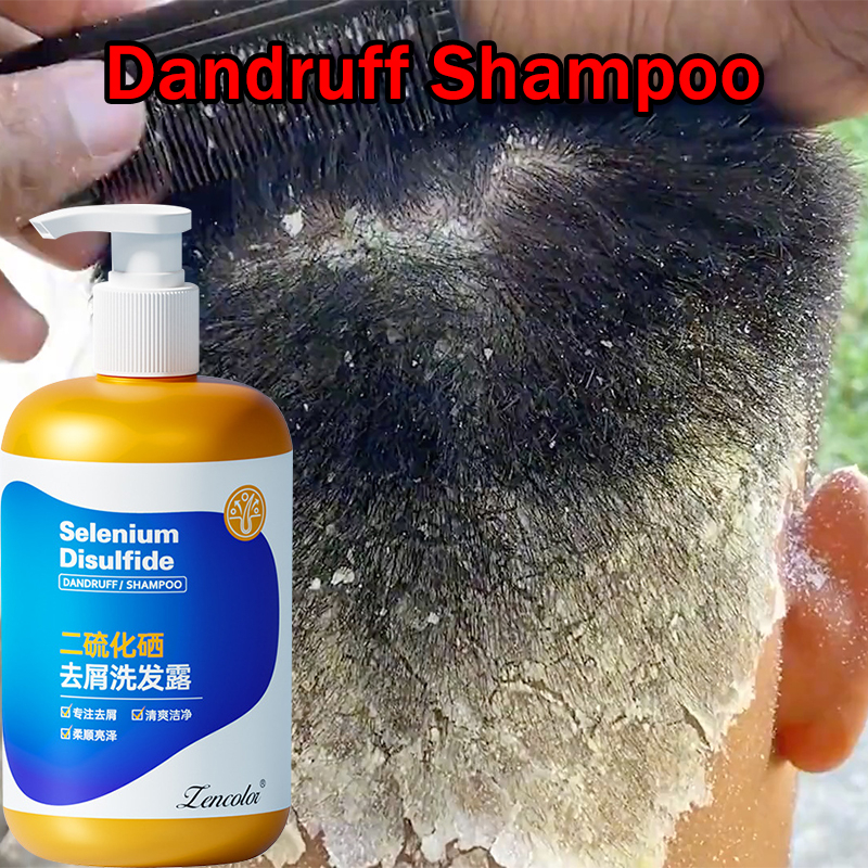 shampoo kelemumur anti dandruff shampoo scalp shampoo hair care itchy ...