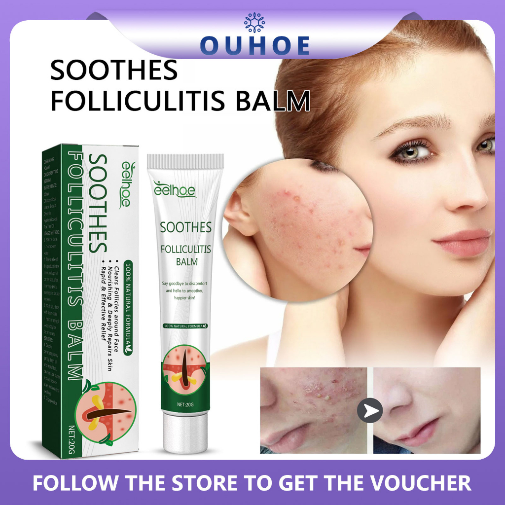 EELHOE Soothes Folliculitis Balm Folliculitis Psoriasis Cream Treat ...