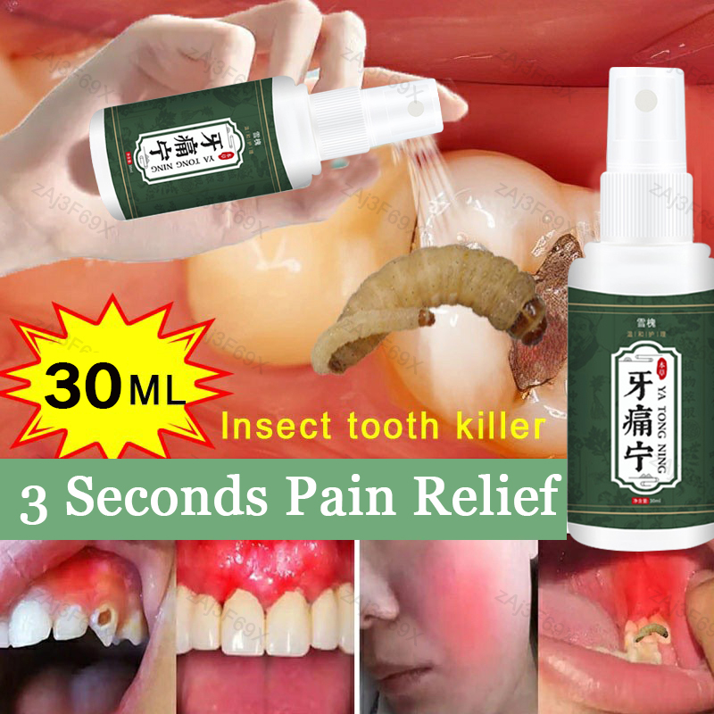 Toothache Treatment Spray Relieves Periodontitis Tooth Decay Pains