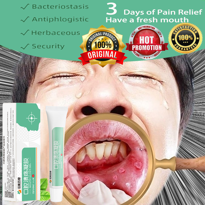 Natural Chinese herbal medicine Aphthous stomatitis oral pain relief Aphthous stomatitis pain
