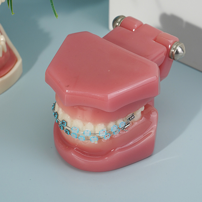 Dental Teeth Model with Metal Bracket Arch Wire Buccal Tube Ligature ...