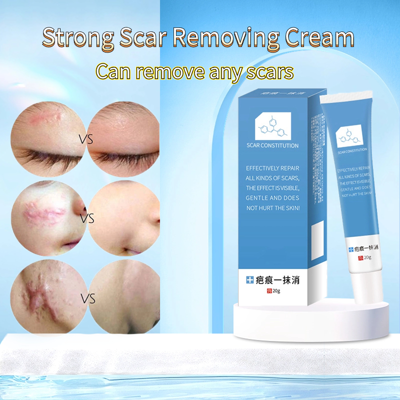 Scar removal cream can reduce keloids depressed scars dark scars ...