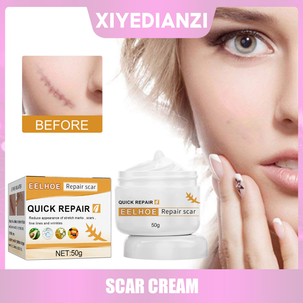 Eelhoe Scar repair ointment skin 50g Scar remover gel cream Whitening moisturizer for old scar