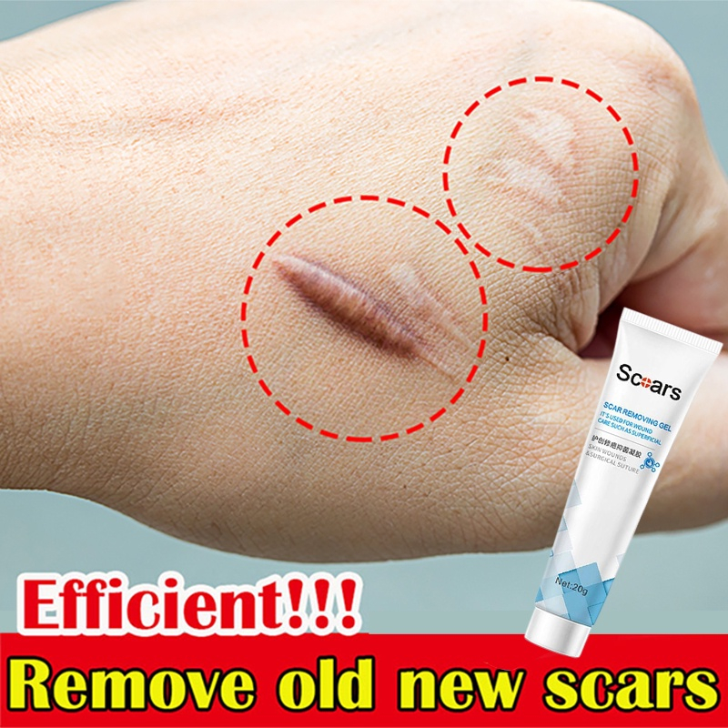 Scar Cream Old Scar New Scar Painless 7 days quickly eliminate medical