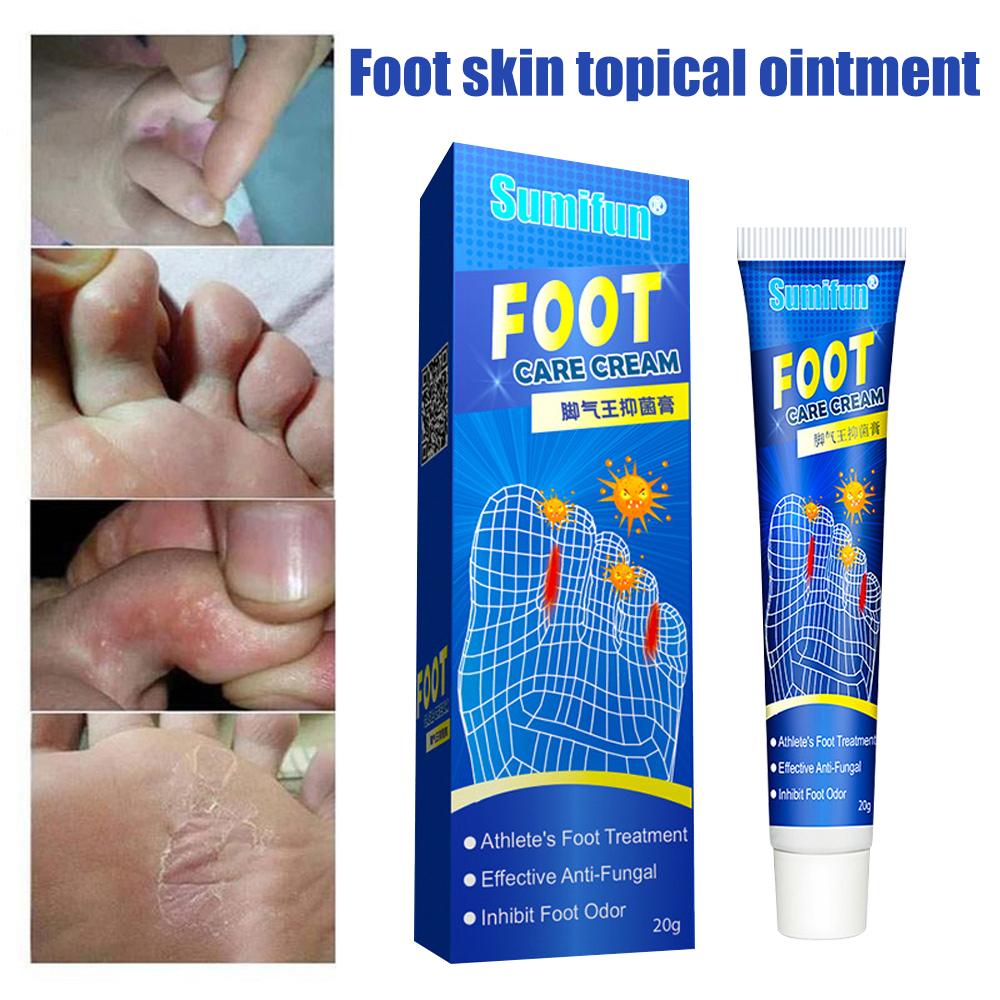 Sumifun Antifungal Cream 20g/Athlete's Foot Cream for Beriberi Itching