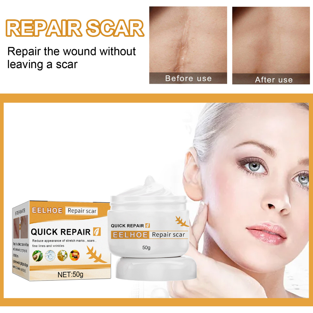 EELHOE Quick Repair Scar Cream Scar Removal Repair Wound Fade Skin