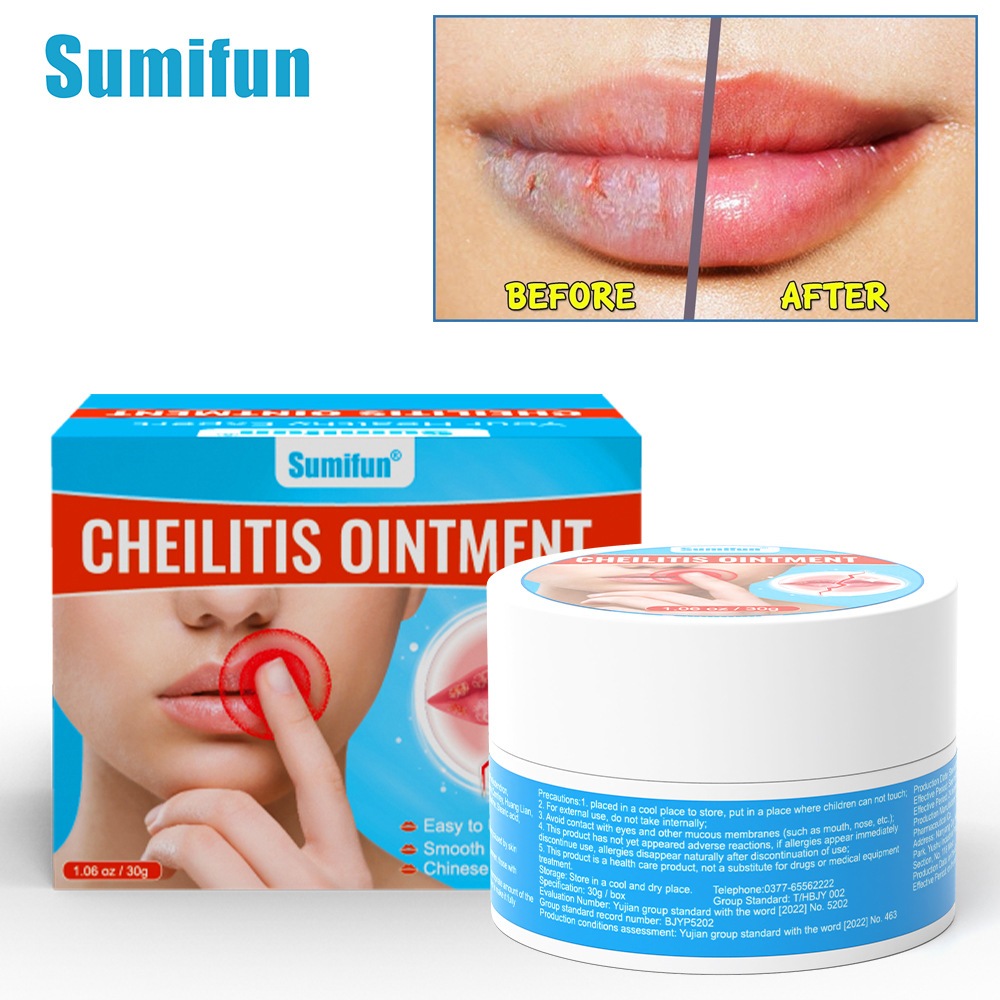 Cheilitis Cream Open Lip Cream for Chapped, Peeling and Bleeding Lips