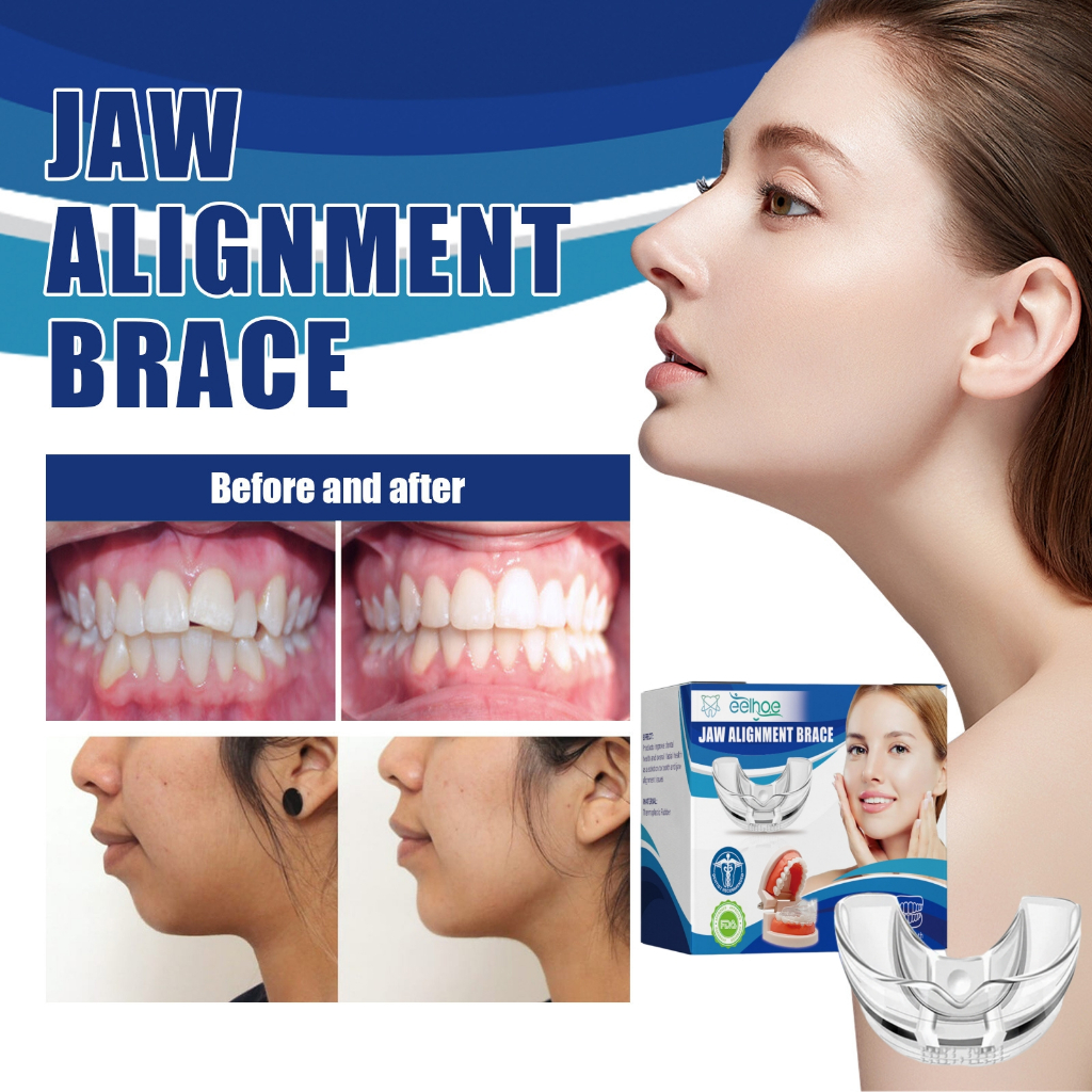 Invisible Braces Orthodontic Braces Jaw Adjustment Brackets Misaligned