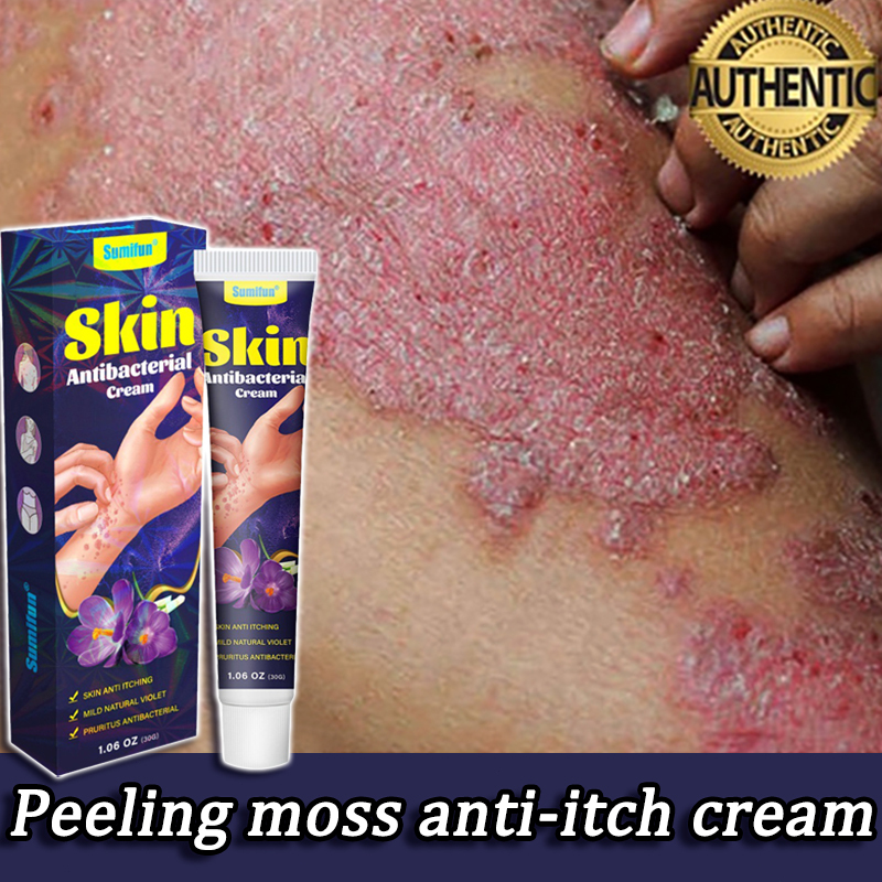 krim gatal obat gatal untuk kulit antifungal cream 30g celah kangkang