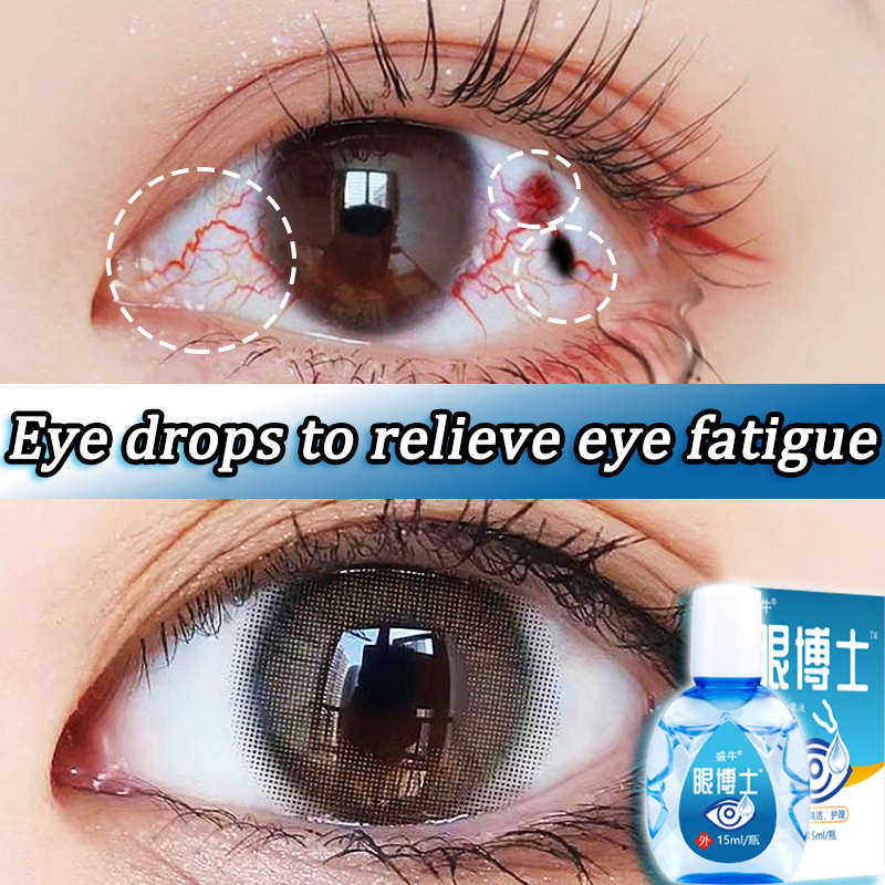 eye drop eye drops for dry eye 15ml Eye Wash Care Eye Washer Eye
