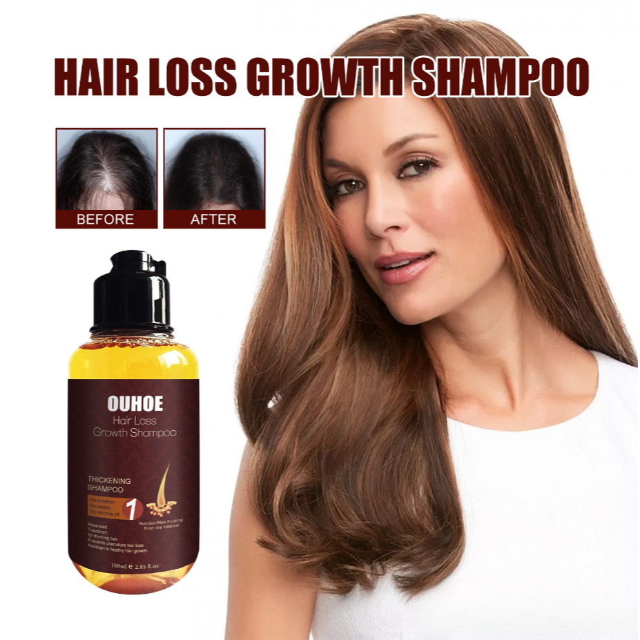 OUHOE Hair Loss Growth Shampoo Scalp Treatment Deep Cleaning Follicles ...