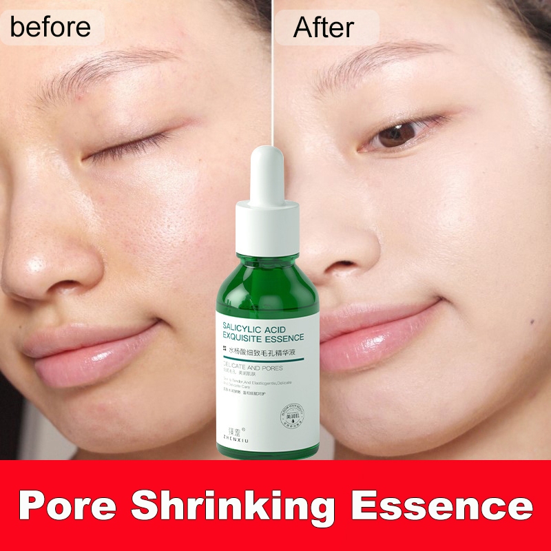 Salicylic acid Shrinking serum Essence Effectively Clean Pore whitening