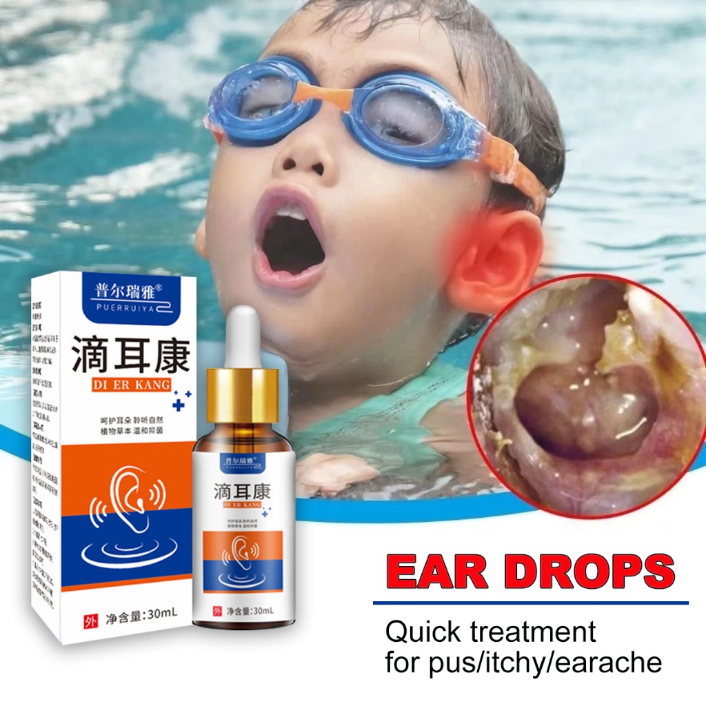 telinga pembersih ear care Ear Drops ear wax remover 30ml for Itchy