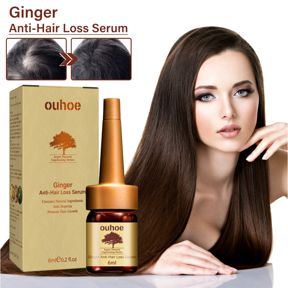 OUHOE Ginger Anti-Hair Loss Serum Repairing Follicles Moisturizing ...