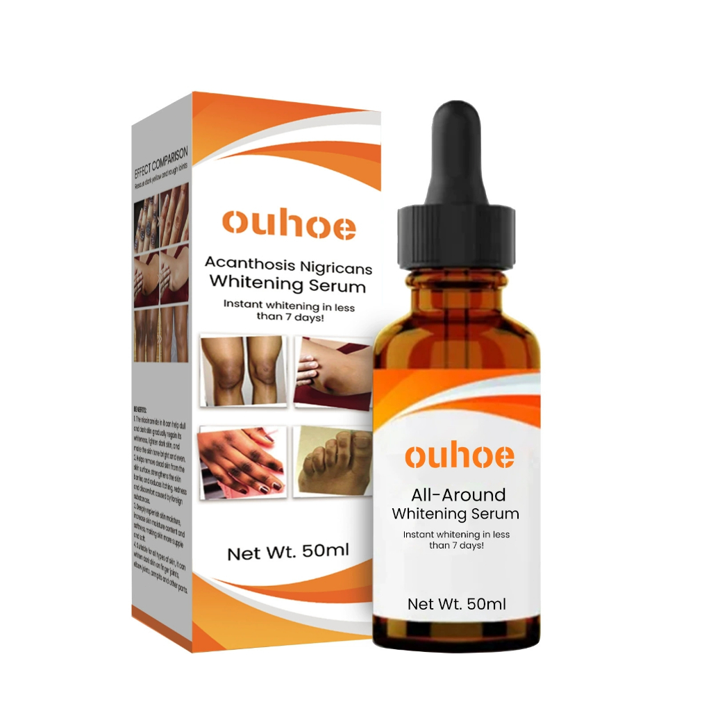 Acanthosis Nigricans Lightening Serum Treatment Oil Dark Knees Elbows ...