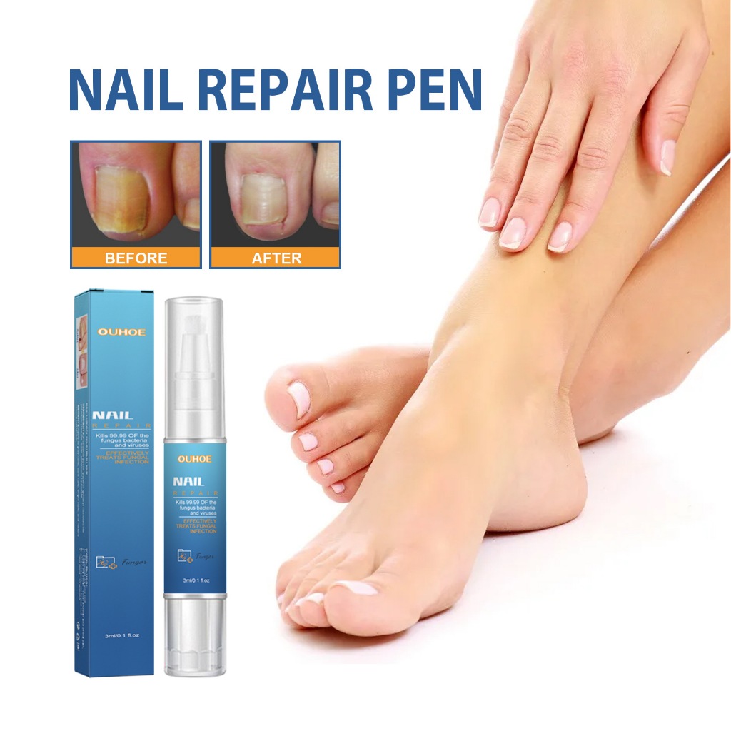 OUHOE Nail Repair Pen3ml Nail Fungal Removal Serum Remove Onychomycosis