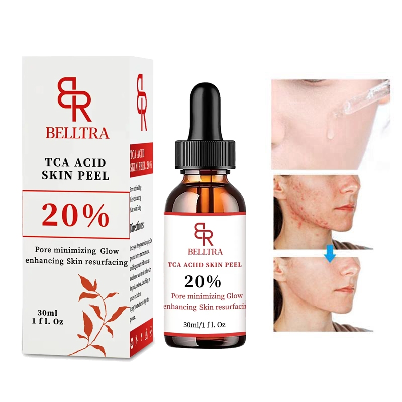 belltra trichloroacetic acid stock solution 30ml TCA AID SKIN PEEL 20 brightens skin tone
